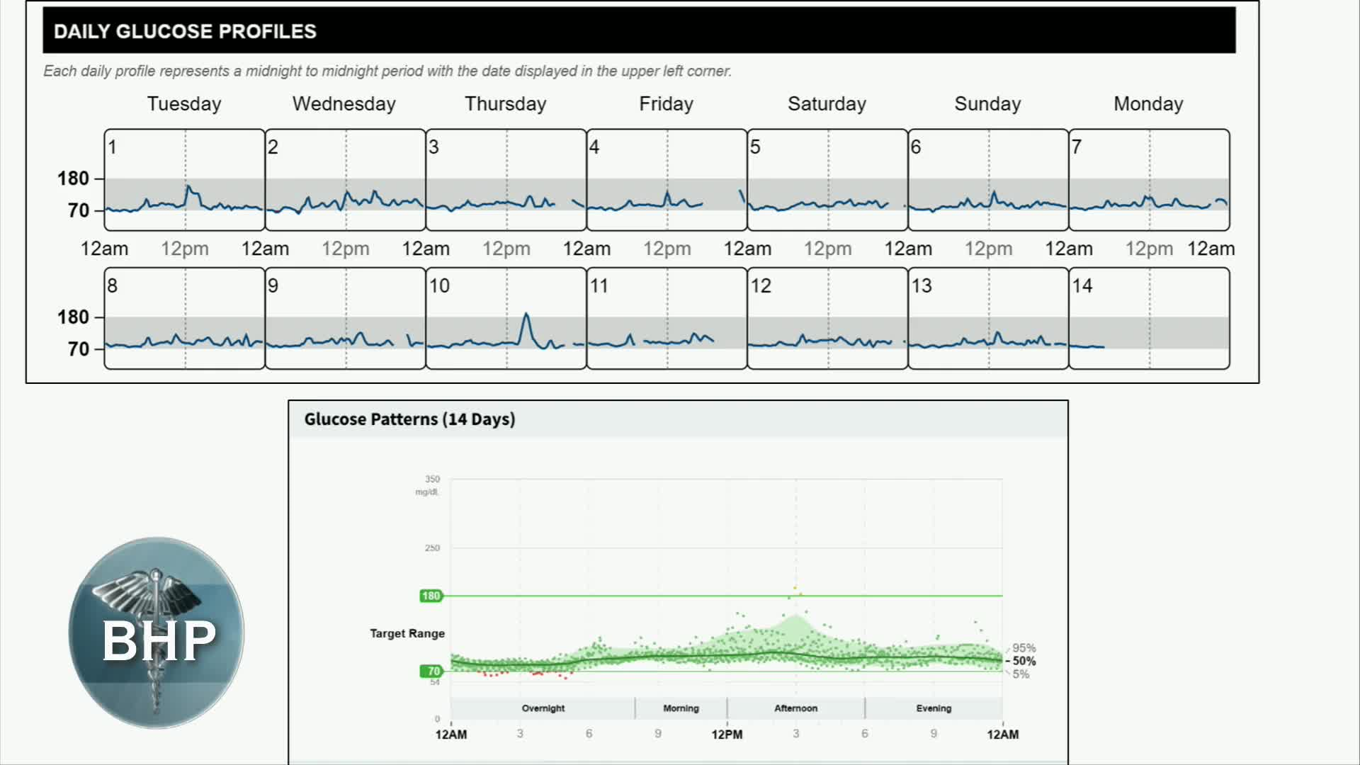Thumbnail image for Berkshire Health Systems presents "Berkshire Health Program: 'Glucose Control,' with Timothy Korte."